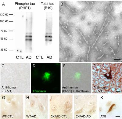 Intravenous Injection of PHF-Tau Proteins From Alzheimer Brain Exacerbates Neuroinflammation, Amyloid Beta, and Tau Pathologies in 5XFAD Transgenic Mice